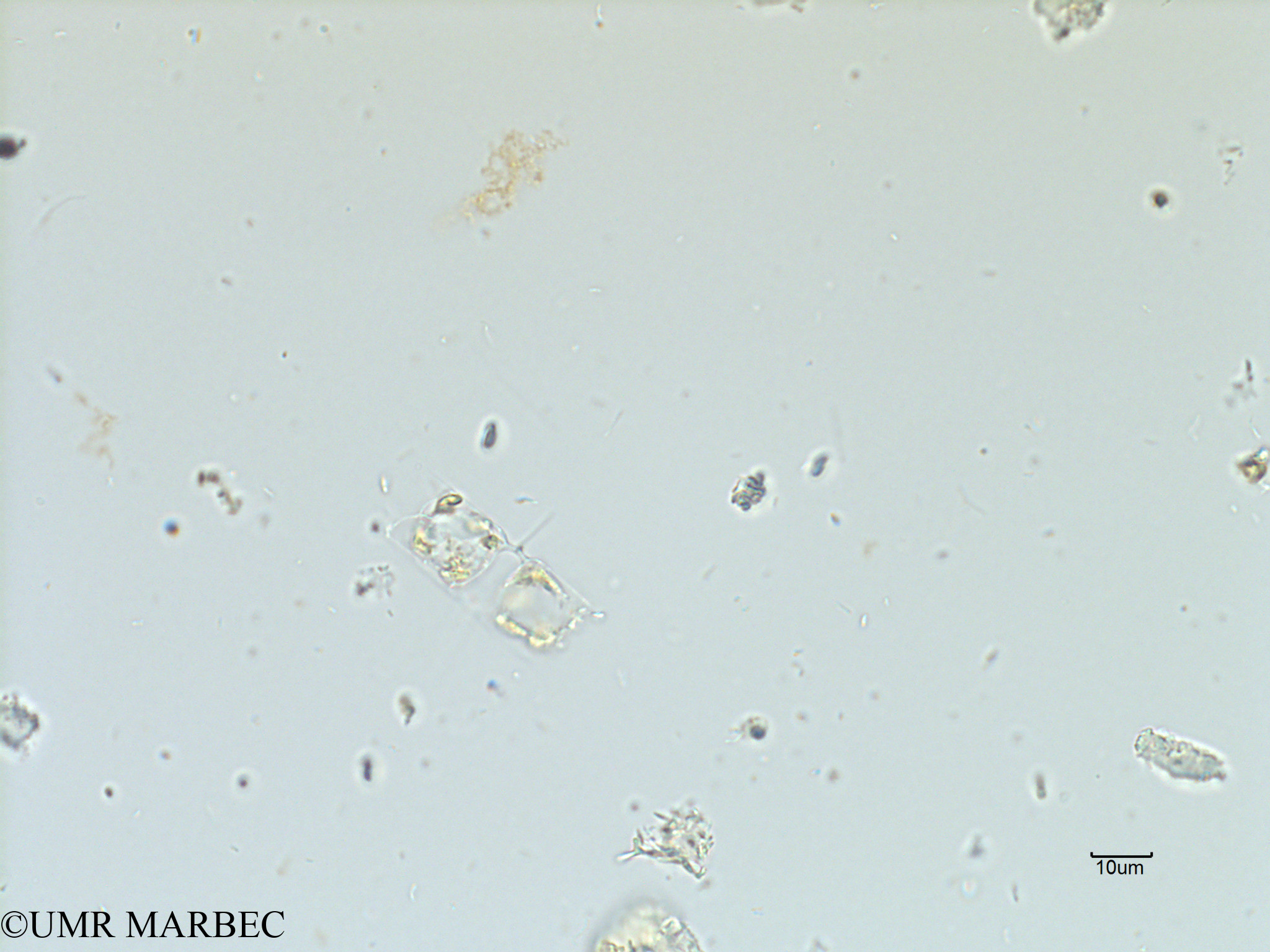 phyto/Scattered_Islands/iles_glorieuses/SIREME November 2015/Chaetoceros sp23 (SIREME-Glorieuses2015-ech6-211116-photo27 ch sp22)(copy).jpg